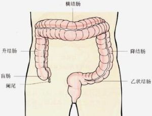 慢性结肠炎多久能治好